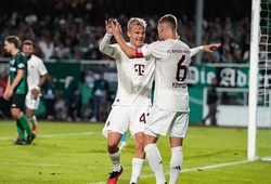 Nhận định, soi kèo Saarbrucken vs Bayern Munich: Khách lấn chủ