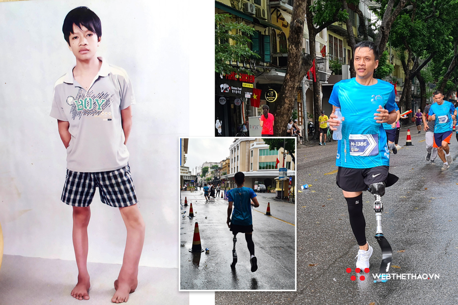 Chàng trai cụt chân vì mọt xương nỗ lực hoàn thành đường chạy 10km