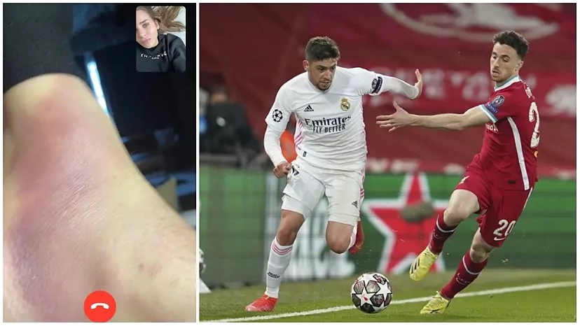 Sao Real Madrid đá cả trận gặp Liverpool với đôi chân bầm tím