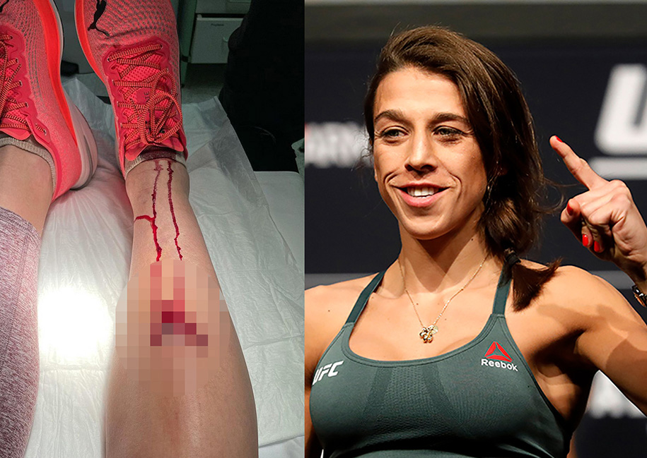 Joanna Jedzejczyk khoe vết thương khi tập luyện: Bạn còn muốn làm võ sĩ?