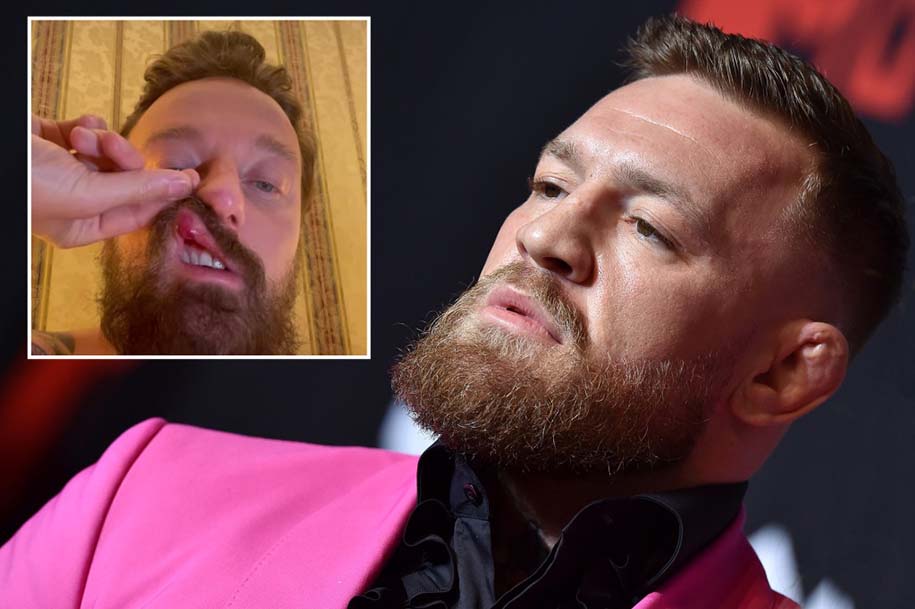 Vụ Conor McGregor bị tố tấn công DJ người Ý: Đối phương bị đánh gãy mũi, đã gửi đơn kiện