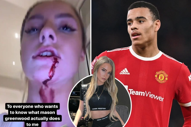 Hình ảnh Mason Greenwood hành hung bạn gái gây sốc Hình ảnh Mason Greenwood hành hung bạn gái gây sốc