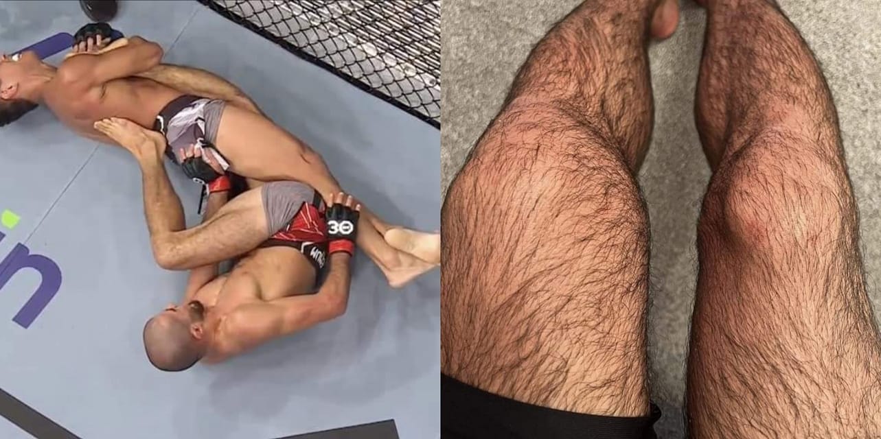 UFC 286: Muhammad Mokaev nói gì về tình huống "thà bị bẻ gãy chân chứ không hàng"