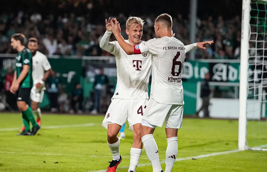 Nhận định, soi kèo Saarbrucken vs Bayern Munich: Khách lấn chủ