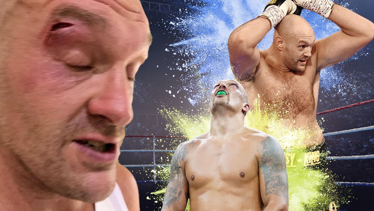 NÓNG: Tyson Fury rách mắt, dời lịch trận so găng Oleksandr Usyk