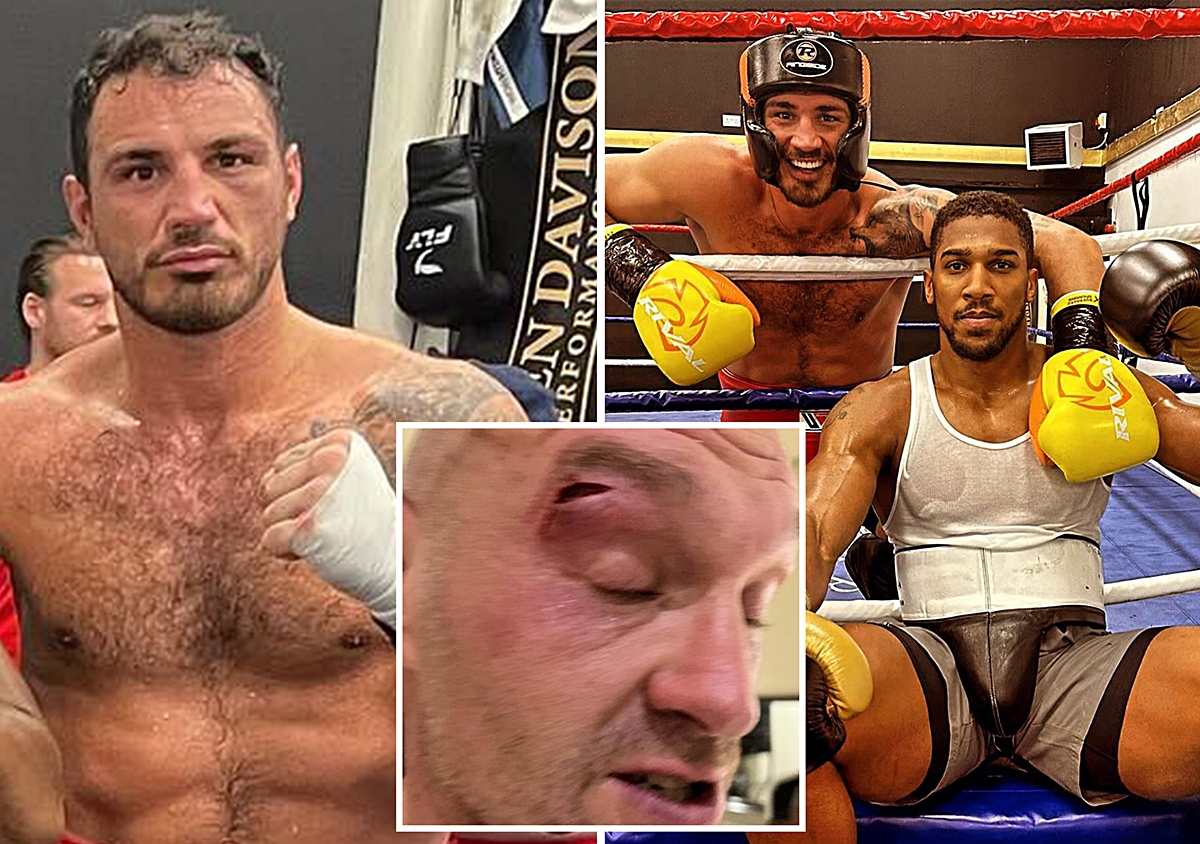 Trận Tyson Fury - Usyk bị hoãn nhưng "thủ phạm đấm rách mắt" vẫn không xin lỗi