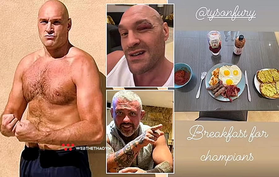 Tyson Fury dùng "thức ăn đặc biệt" chữa nhanh vết rách ở mắt để kịp so găng với Usyk