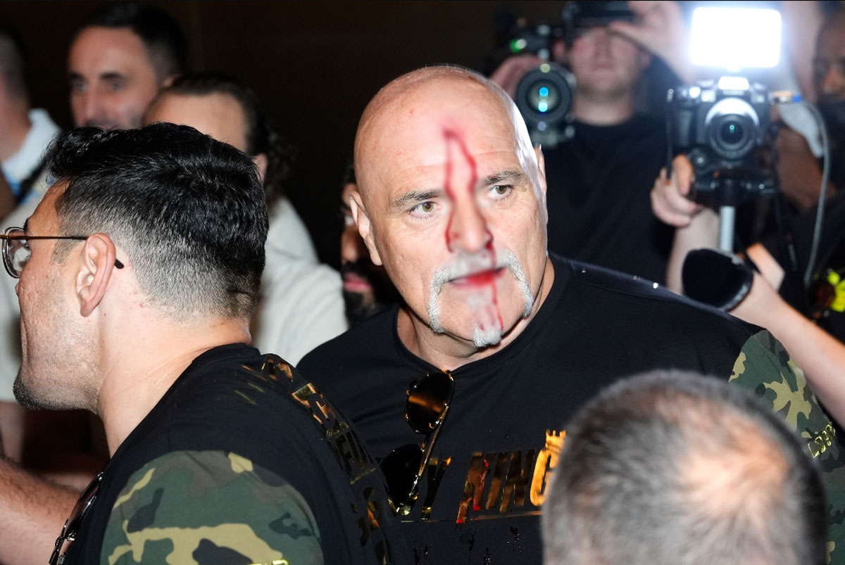Bố Tyson Fury xô xát với Team Oleksandr Usyk tới chảy máu đầu
