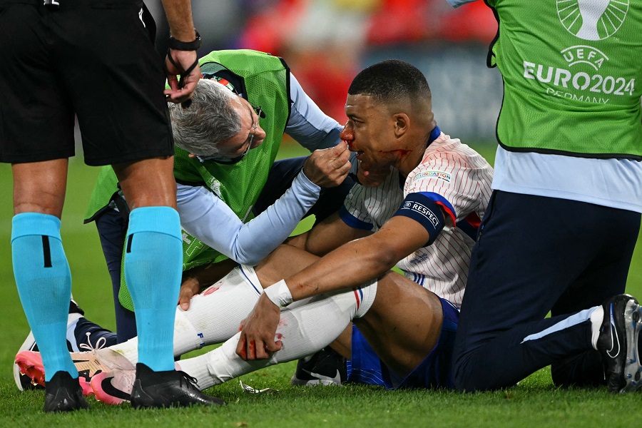 Cận cảnh chấn thương mũi của Mbappe khiến tuyển Pháp lo ngại