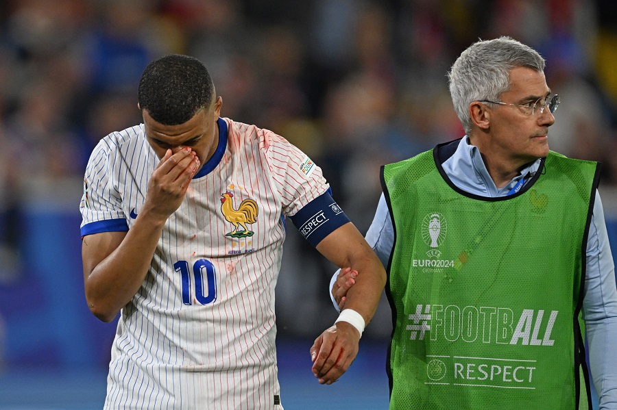 Mbappe phản ứng hài hước khi bị gãy mũi
