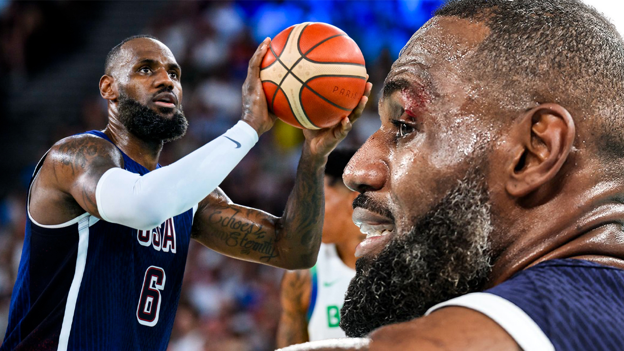 LeBron James rách mí mắt, khâu 4 mũi trước thềm 2 trận cuối cùng tuyển Mỹ tại Olympic 2024 LeBron James rách mí mắt, khâu 4 mũi trước thềm 2 trận cuối cùng tuyển Mỹ tại Olympic 2024