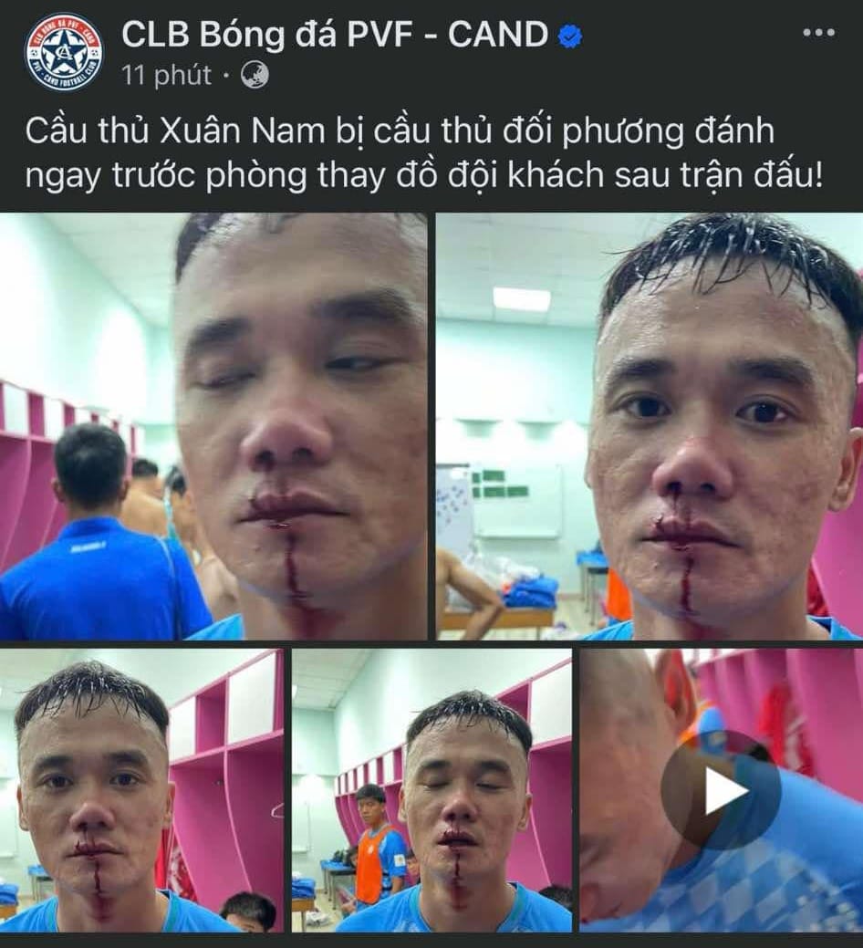 Sự th&acirc;̣t cựu tuy&ecirc;̉n thủ QG Xu&acirc;n Nam bị đ&aacute;nh đ&ocirc;̉ m&aacute;u trong đường h&acirc;̀m