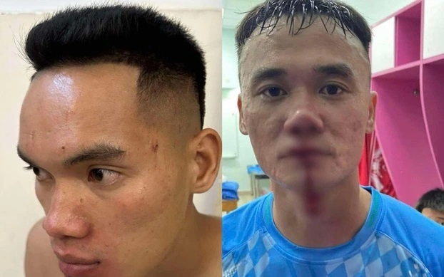 Đánh nhau gây đổ máu, Xuân Nam và Vũ Văn Sơn nhận án phạt thích đáng Đánh nhau gây đổ máu, Xuân Nam và Vũ Văn Sơn nhận án phạt thích đáng