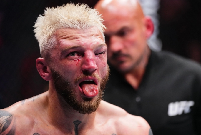 Ba võ sĩ phải nhập viện sau sự kiện UFC Qatar khốc liệt