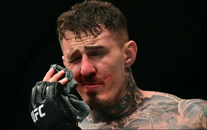 Tom Aspinall phải phẫu thuật hai mắt sau sự cố chọc mắt tại UFC 321 Tom Aspinall phải phẫu thuật hai mắt sau sự cố chọc mắt tại UFC 321