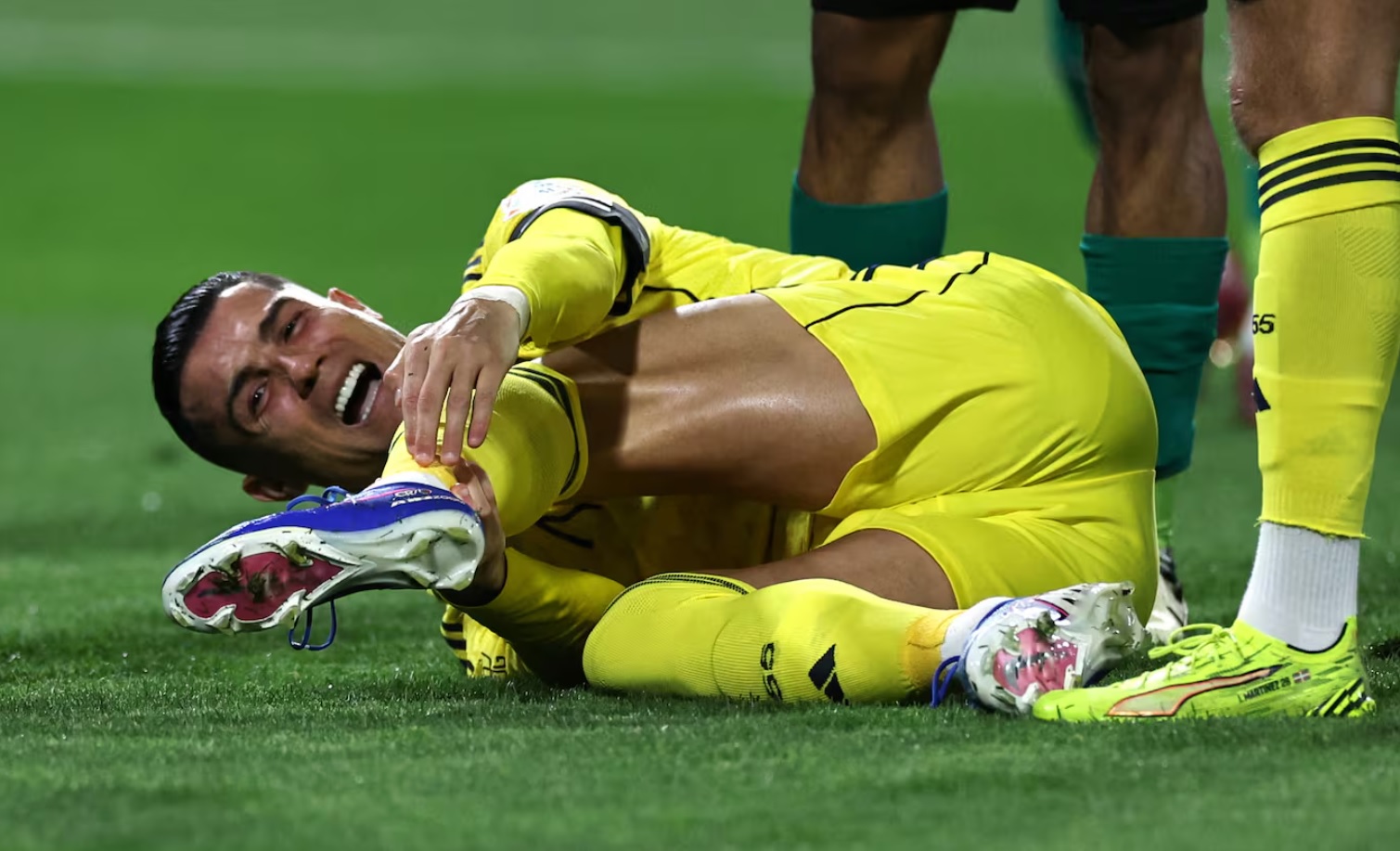 Cristiano Ronaldo hồi hộp chờ kết quả chụp MRI cho chấn thương