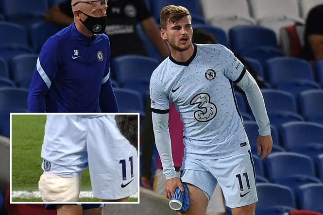 Timo Werner phải băng đầu gối khi Chelsea chuẩn bị gặp Liverpool