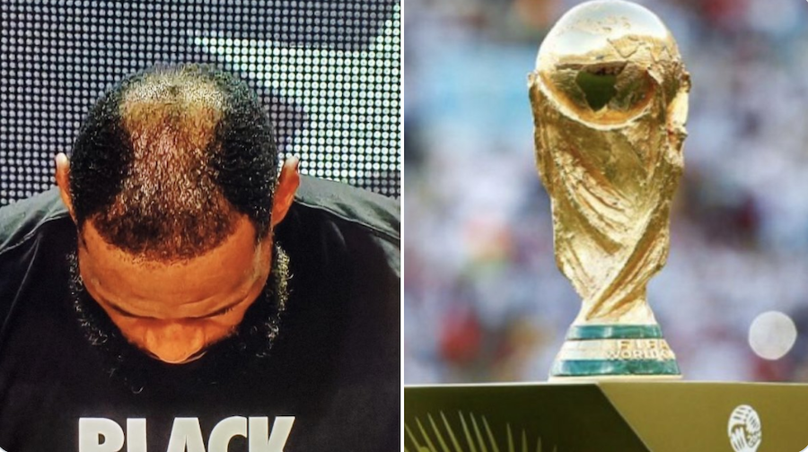 Vết hói đầu của LeBron James bị troll không thương tiếc