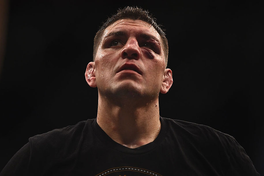 Các võ sĩ rào trước đón sau gạ kèo Nick Diaz tái xuất