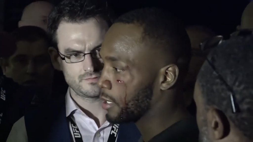 Gạ kèo, Leon Edwards bị Jorge Masvidal đấm rách mặt sau buổi họp báo UFC