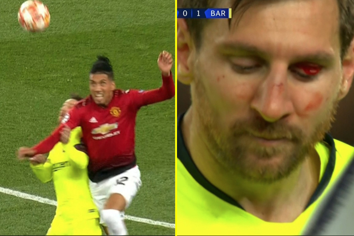 Tiết lộ sốc: Messi không thể thở bình thường sau pha va chạm kinh hoàng với Smalling