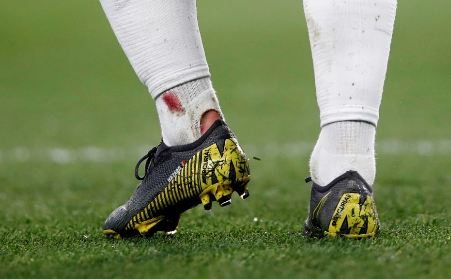 Hazard bị đối thủ phạm lỗi đến mức chảy máu và rách cả bít tất