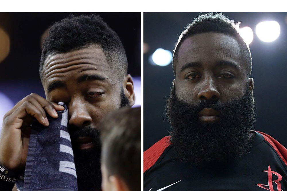 James Harden sau pha vô tình "móc mắt" của Draymond Green: Tôi chả nhìn thấy gì cả