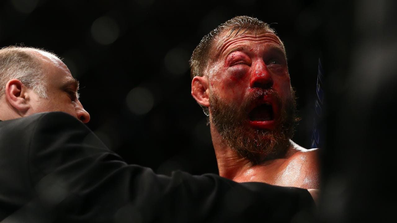 Vì sao hỉ mũi lại khiến mắt Donald Cerrone sưng húp?