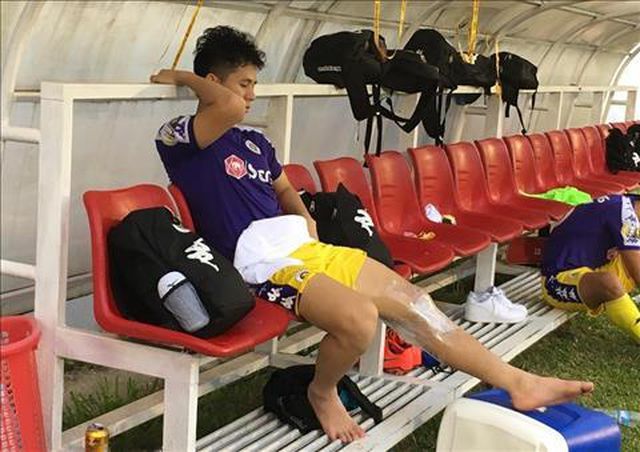 Nối gót chấn thương của Rô “béo”, Tuấn Anh, sự nghiệp của Đình Trọng gặp nguy hiểm