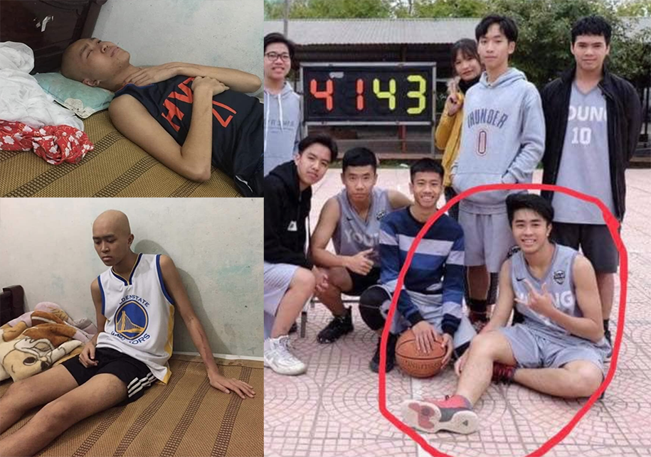 Cùng cộng đồng bóng rổ chung tay giúp "baller" trẻ bị ung thư tại thành phố Hoà Bình