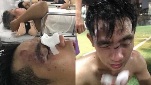 Thắng đậm đối thủ bắt qua mạng, đội bóng sinh viên bị đánh đến nhập viện