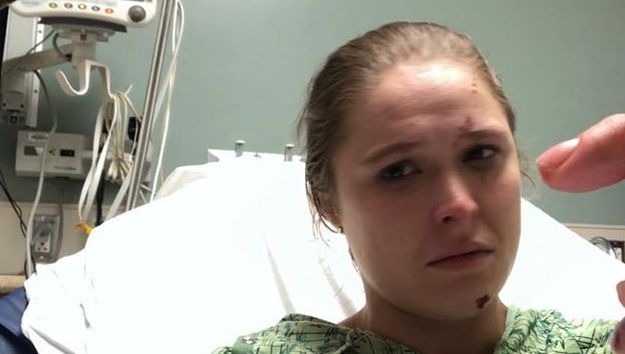 Ronda Rousey suýt mất ngón tay vì tai nạn trên phim trường