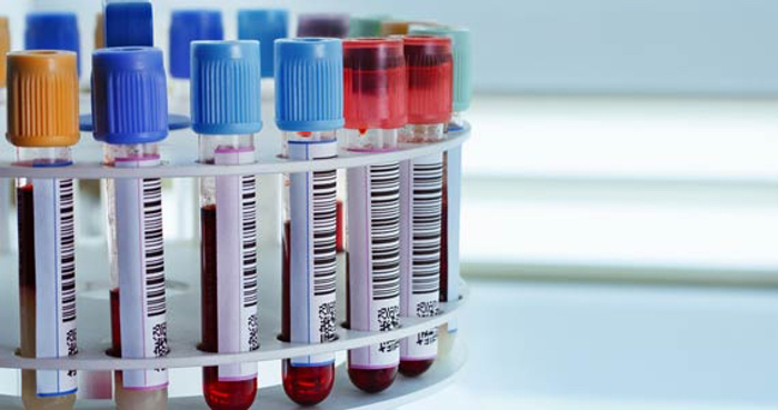 Các võ sĩ UFC xét nghiệm Doping như thế nào?