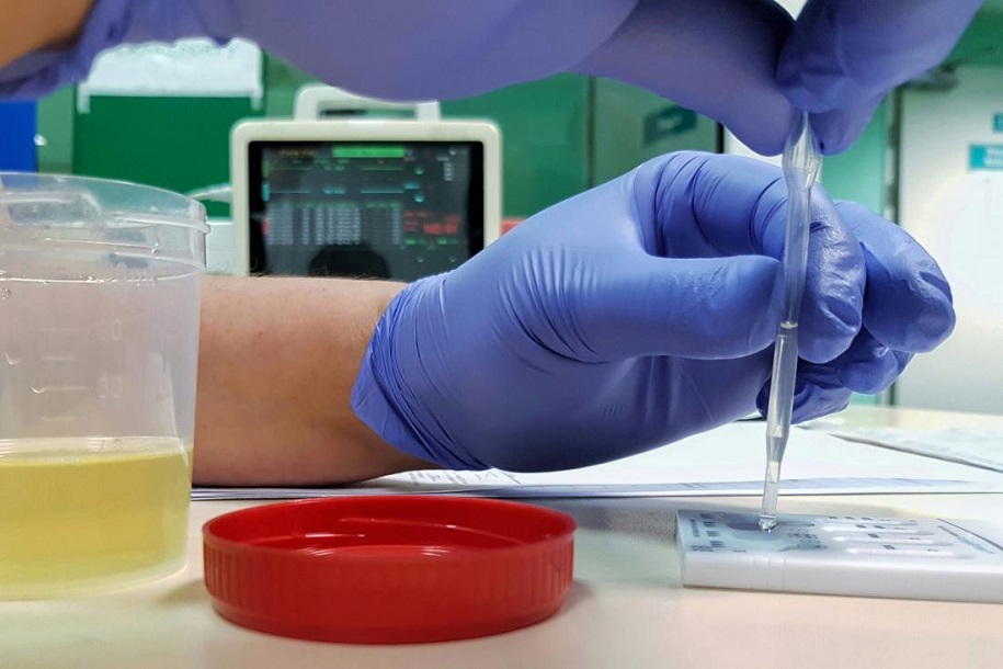 Các võ sĩ UFC xét nghiệm Doping như thế nào?