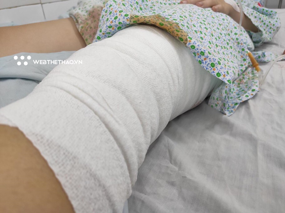 Nữ CĐV bị trúng pháo sáng được mổ thành công lần 1