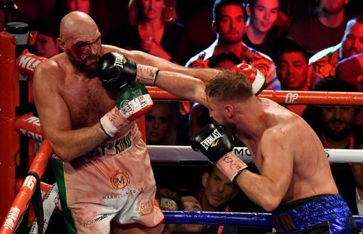 Tyson Fury khâu 50 mũi sau trận đấu với Otto Wallin Tyson Fury khâu 50 mũi sau trận đấu với Otto Wallin