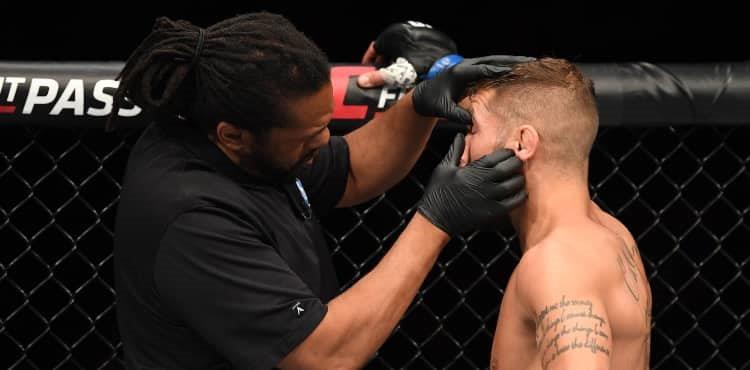 Jeremy Stephens yêu cầu tái đấu với Yair Rodriguez sau cú chọc mắt