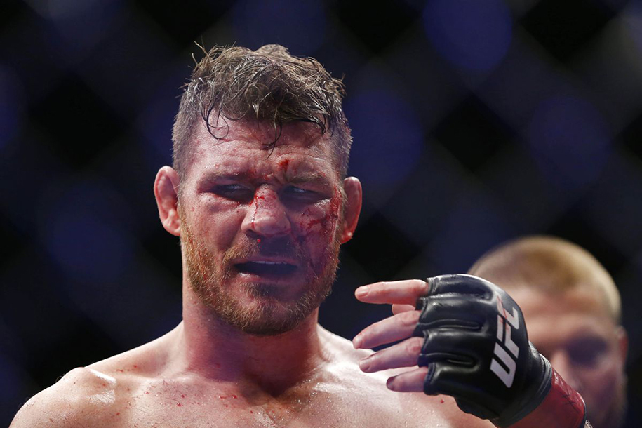 Cựu vô địch UFC Michael Bisping tự hào khoe mắt giả ngay giữa show trực tiếp