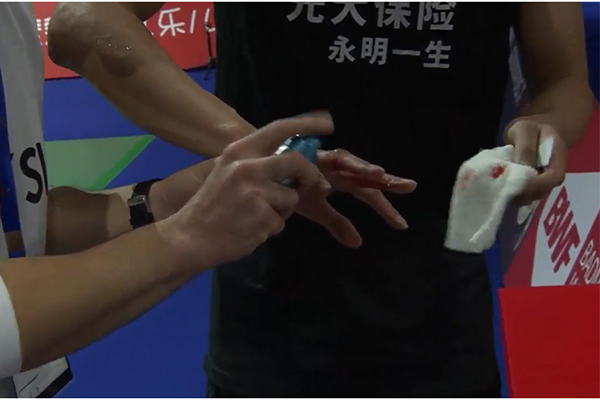 Kết quả cầu lông hôm nay 16/10: Chen Long đổ máu, Lee Zii Jia chèm bẹp