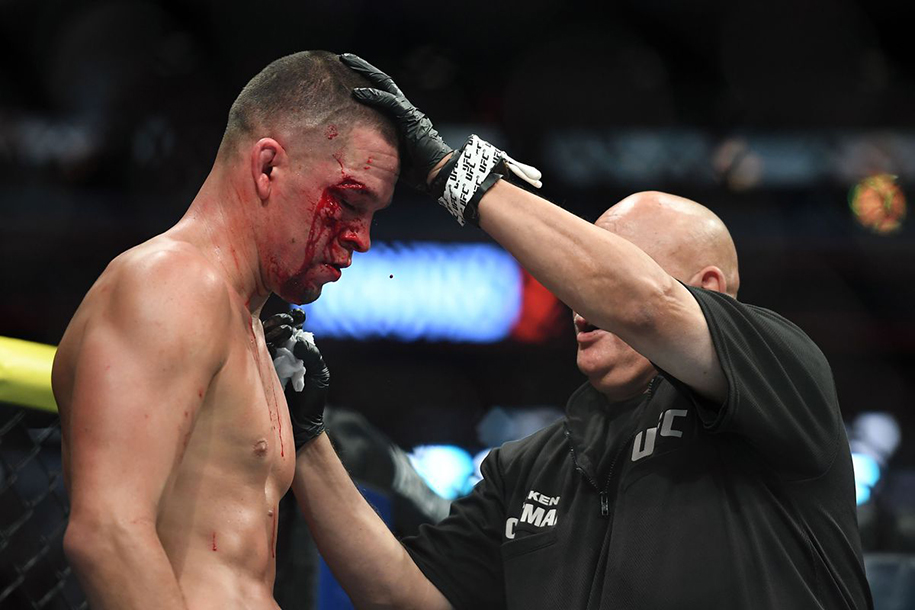 Bác sĩ tại UFC 244 nhận nhiều tin nhắn đe dọa vì dừng trận Diaz vs. Masvidal