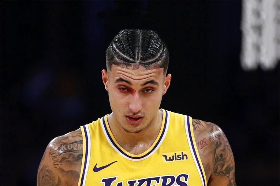 Kyle Kuzma bị rách giác mạc, mắt rướm máu