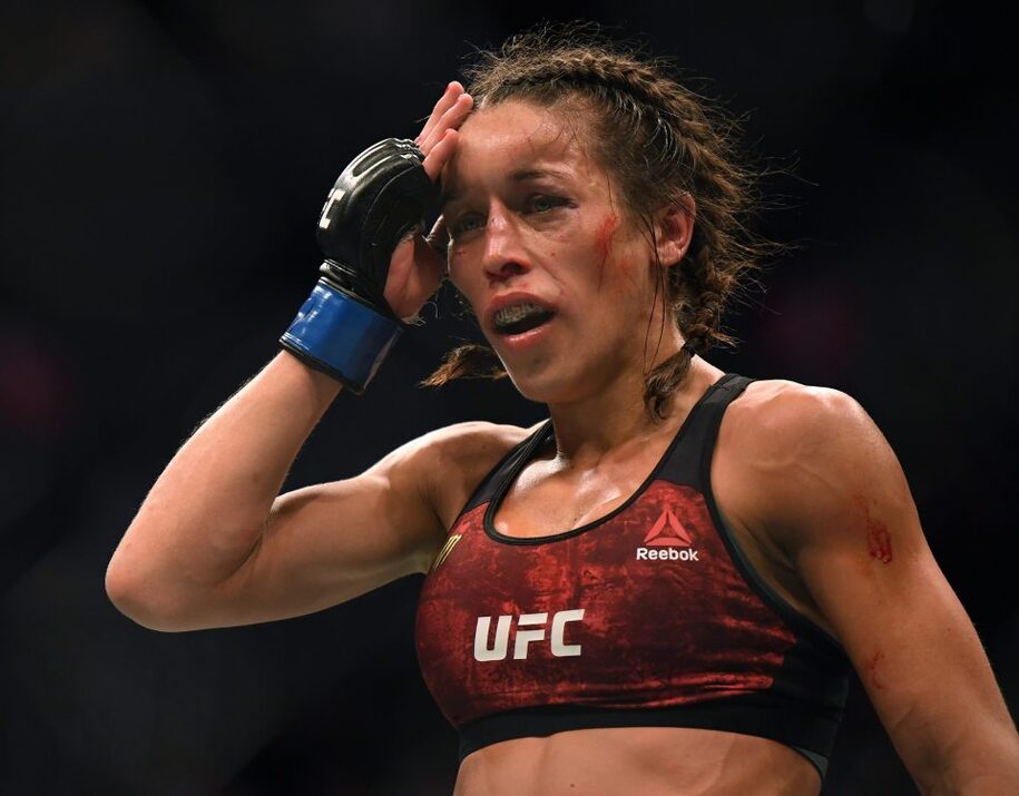 Chấn thương gây biến dạng của Joanna Jedrzejczyk