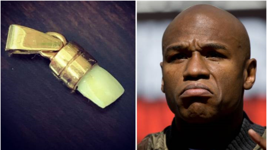 Maidana tuyên bố vẫn còn giữ chiếc răng bị đấm gãy của Mayweather