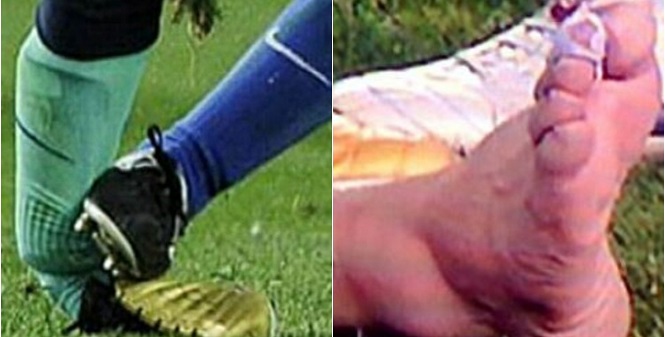Sự thật cú đá tồi tệ nhất mà Messi chịu đựng trong sự nghiệp Sự thật cú đá tồi tệ nhất mà Messi chịu đựng trong sự nghiệp
