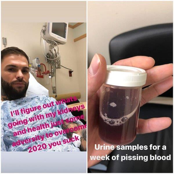Cody Garbrandt lỡ hẹn với võ đài vì phải nhập viện
