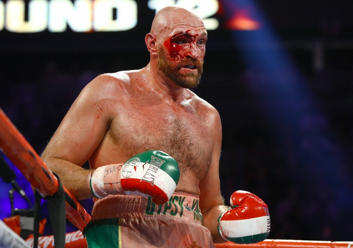 Tyson Fury: Một là knockout Deontay Wilder, hai là ra về trên cáng cứu thương