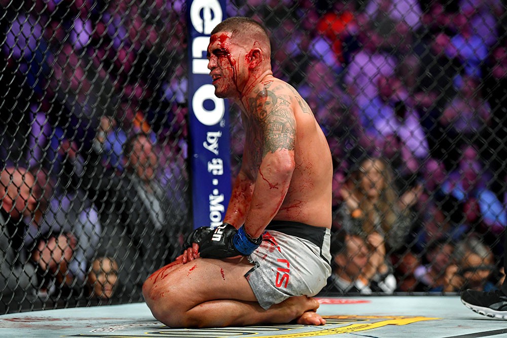 Anthony Pettis gãy xương bàn tay trong cuộc đối đầu với Tony Ferguson - Ảnh 11. Anthony Pettis gãy xương bàn tay trong cuộc đối đầu với Tony Ferguson - Ảnh 11.