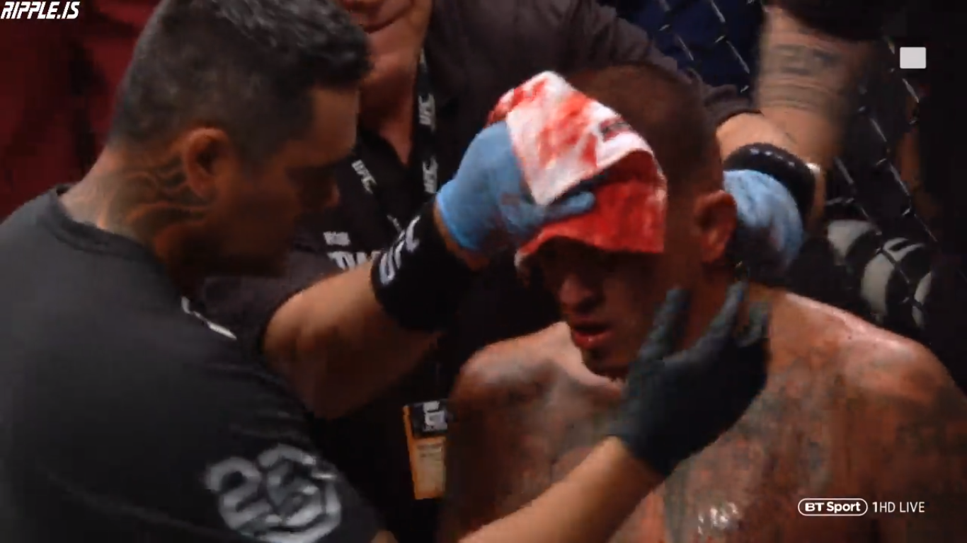 Anthony Pettis gãy xương bàn tay trong cuộc đối đầu với Tony Ferguson - Ảnh 9. Anthony Pettis gãy xương bàn tay trong cuộc đối đầu với Tony Ferguson - Ảnh 9.