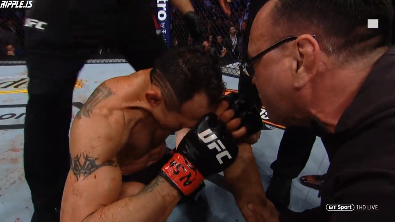 Anthony Pettis gãy xương bàn tay trong cuộc đối đầu với Tony Ferguson - Ảnh 12. Anthony Pettis gãy xương bàn tay trong cuộc đối đầu với Tony Ferguson - Ảnh 12.