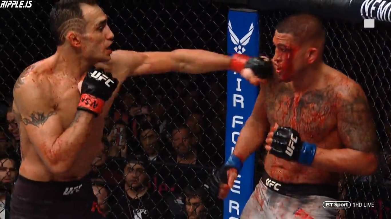 Anthony Pettis gãy xương bàn tay trong cuộc đối đầu với Tony Ferguson